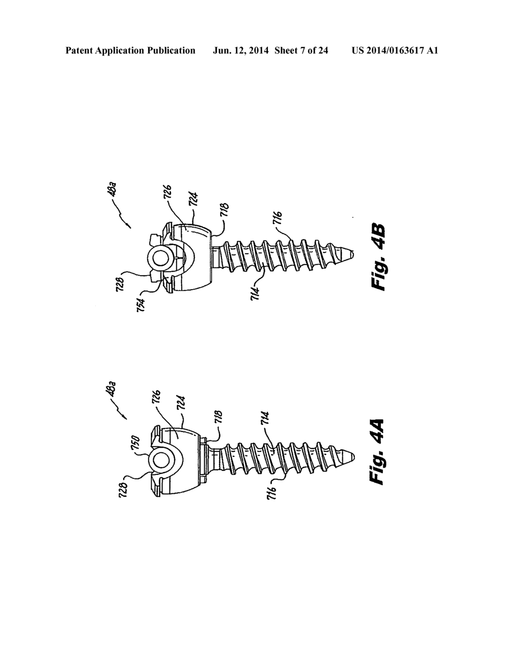 SYSTEM AND METHOD FOR PERFORMING SPINAL SURGERY - diagram, schematic, and image 08