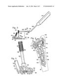 TARGETING GUIDE WITH A RADIOPAQUE MARKER TO FACILITATE POSITIONING A BONE     PLATE ON BONE diagram and image