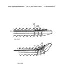 Bone Screw with Deflectable Portion diagram and image