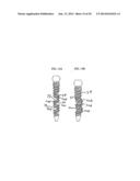 Bone Screw with Deflectable Portion diagram and image