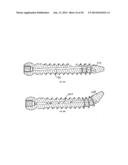 Bone Screw with Deflectable Portion diagram and image