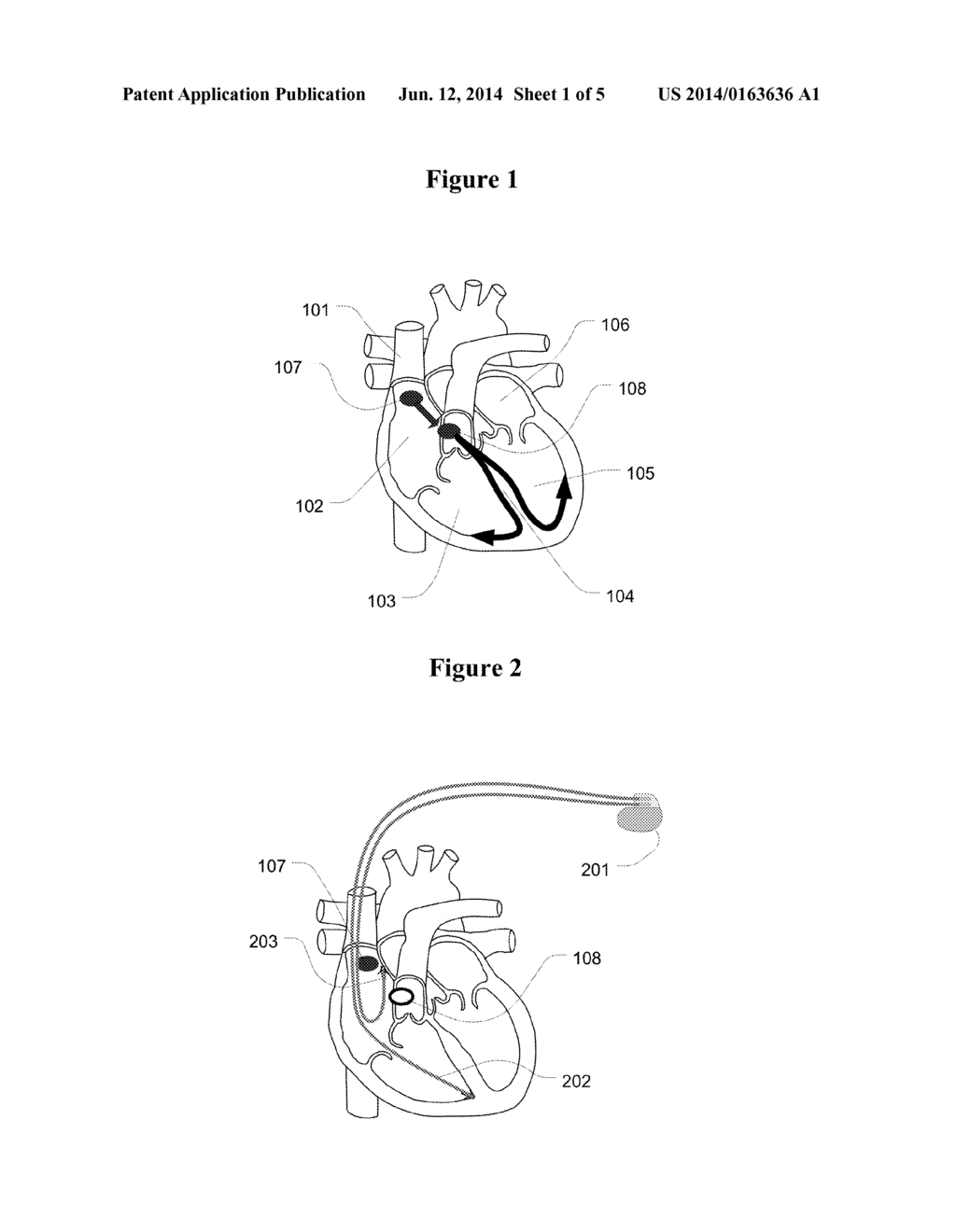 Methods and Apparatus to Stimulate Heart Atria - diagram, schematic, and image 02