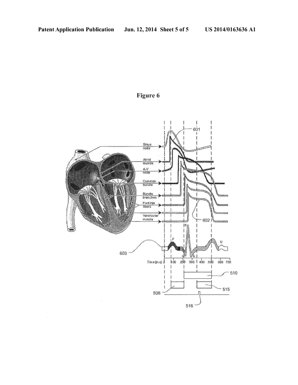 Methods and Apparatus to Stimulate Heart Atria - diagram, schematic, and image 06