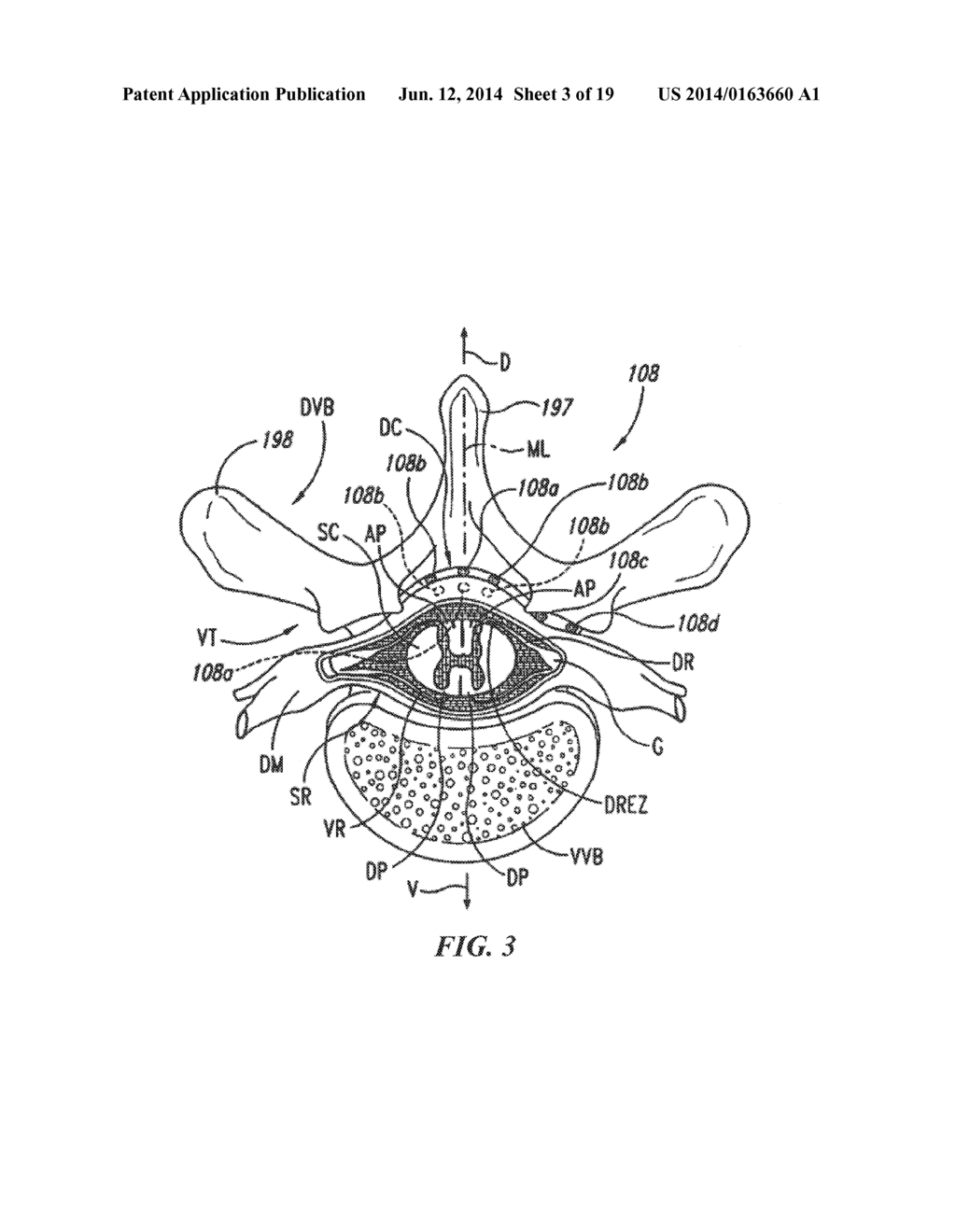 MULTI-FREQUENCY NEURAL TREATMENTS AND ASSOCIATED SYSTEMS AND METHODS - diagram, schematic, and image 04