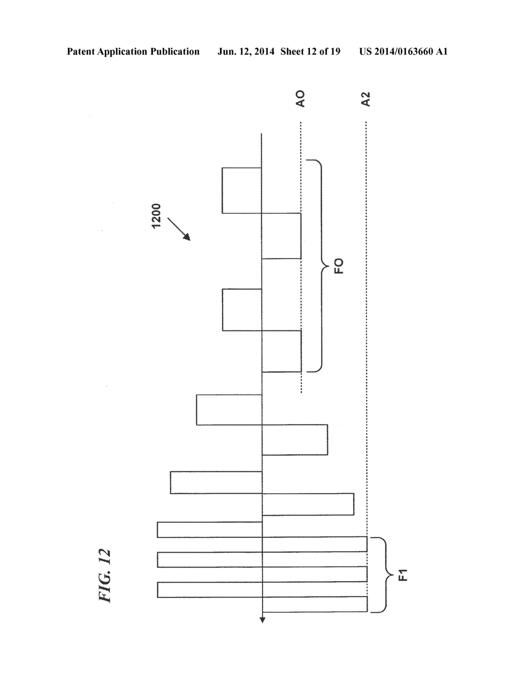 MULTI-FREQUENCY NEURAL TREATMENTS AND ASSOCIATED SYSTEMS AND METHODS - diagram, schematic, and image 13