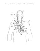 ELECTRODE CUFFS diagram and image