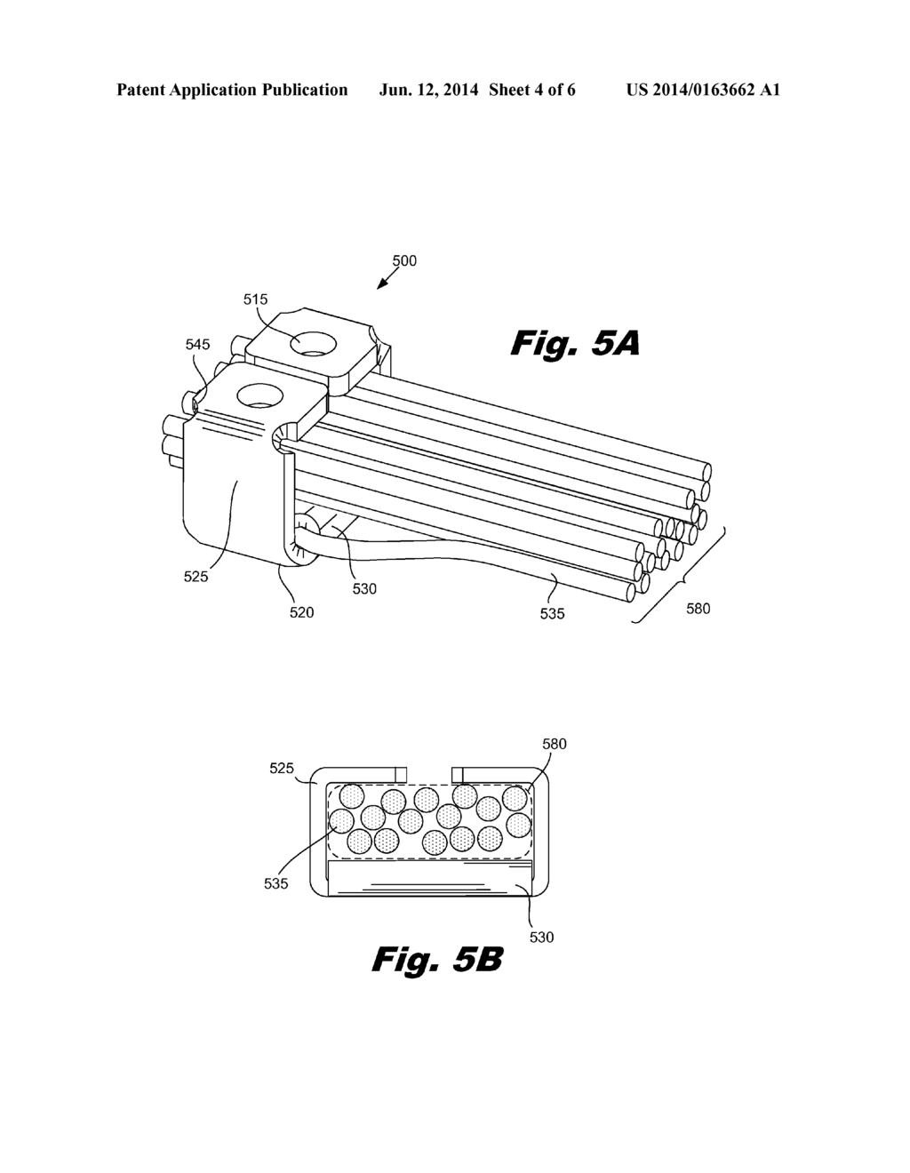 INTEGRATED WIRE CARRIER FOR ELECTRODE ARRAY - diagram, schematic, and image 05