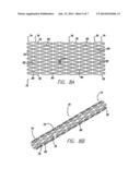 INTRAVASCULAR STENT diagram and image