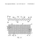 INTRAVASCULAR STENT diagram and image