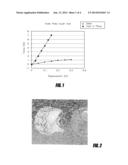 STENTLESS AORTIC VALVE REPLACEMENT WITH HIGH RADIAL STRENGTH diagram and image