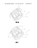 STENTLESS AORTIC VALVE REPLACEMENT WITH HIGH RADIAL STRENGTH diagram and image