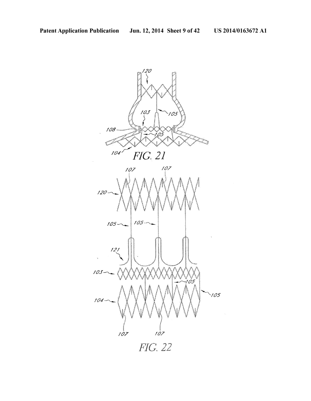 Transcatheter Heart Valves - diagram, schematic, and image 10