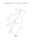 APPARATUS AND METHOD FOR RECONSTRUCTING A LIGAMENT diagram and image