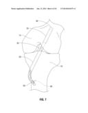 APPARATUS AND METHOD FOR RECONSTRUCTING A LIGAMENT diagram and image