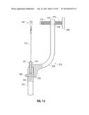 APPARATUS AND METHOD FOR RECONSTRUCTING A LIGAMENT diagram and image