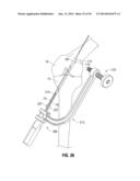 APPARATUS AND METHOD FOR RECONSTRUCTING A LIGAMENT diagram and image