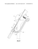 APPARATUS AND METHOD FOR RECONSTRUCTING A LIGAMENT diagram and image