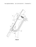 APPARATUS AND METHOD FOR RECONSTRUCTING A LIGAMENT diagram and image