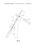 APPARATUS AND METHOD FOR RECONSTRUCTING A LIGAMENT diagram and image