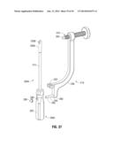 APPARATUS AND METHOD FOR RECONSTRUCTING A LIGAMENT diagram and image