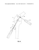 APPARATUS AND METHOD FOR RECONSTRUCTING A LIGAMENT diagram and image