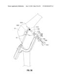 APPARATUS AND METHOD FOR RECONSTRUCTING A LIGAMENT diagram and image