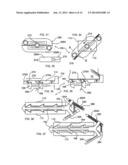 Expandable Vertebral Implant diagram and image