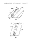 Transforaminal Prosthetic Spinal Disc Apparatus diagram and image