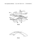 Transforaminal Prosthetic Spinal Disc Apparatus diagram and image