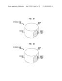 Securable Implantable Component diagram and image