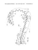 PREFORM FOR AND AN ENDOLUMINAL PROSTHESIS diagram and image