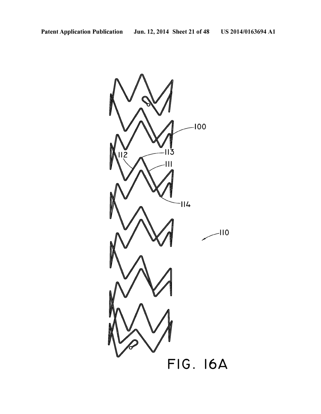 PREFORM FOR AND AN ENDOLUMINAL PROSTHESIS - diagram, schematic, and image 22