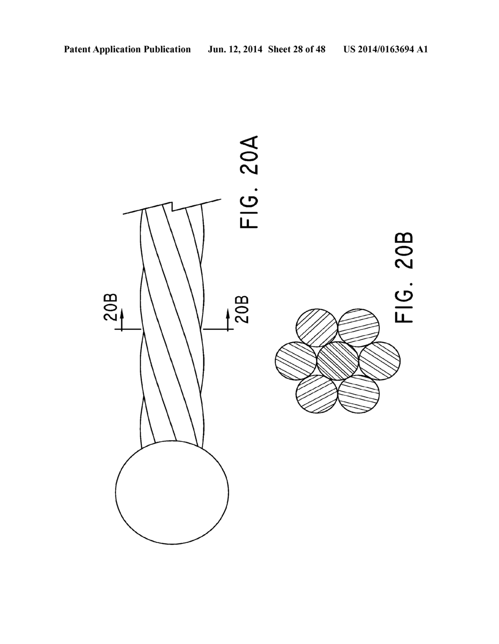 PREFORM FOR AND AN ENDOLUMINAL PROSTHESIS - diagram, schematic, and image 29