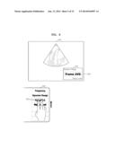 ULTRASOUND APPARATUS AND METHOD OF INPUTTING INFORMATION INTO THE SAME diagram and image