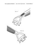 Shaving Systems diagram and image