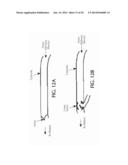 Cannula For Minimizing Dilution Of Dosing During Nitric Oxide Delivery diagram and image