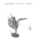 METHODS AND MECHANISMS FOR INFLATION diagram and image