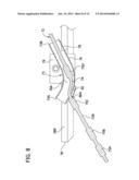 Tree Stand diagram and image