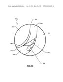 Torque Limiting Tolerance Ring diagram and image