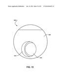 Torque Limiting Tolerance Ring diagram and image