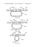 Packaging Material and Method for Microwave and Steam Cooking of Food     Products diagram and image