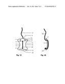 Cord Tensioning Device diagram and image