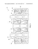 TRACK SHOE AND PIN REMOVAL SYSTEM diagram and image