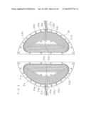 COIL DEVICE AND MAGNETIC RESONANCE IMAGING APPARATUS diagram and image