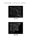 APPARATUS AND METHOD FOR PERFORMING MOTION CAPTURE USING A RANDOM PATTERN     ON CAPTURE SURFACES diagram and image