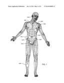 RF FILTER FOR AN ACTIVE MEDICAL DEVICE (AMD) FOR HANDLING HIGH RF POWER     INDUCED IN AN ASSOCIATED IMPLANTED LEAD FROM AN EXTERNAL RF FIELD diagram and image