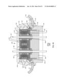 RF FILTER FOR AN ACTIVE MEDICAL DEVICE (AMD) FOR HANDLING HIGH RF POWER     INDUCED IN AN ASSOCIATED IMPLANTED LEAD FROM AN EXTERNAL RF FIELD diagram and image