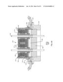 RF FILTER FOR AN ACTIVE MEDICAL DEVICE (AMD) FOR HANDLING HIGH RF POWER     INDUCED IN AN ASSOCIATED IMPLANTED LEAD FROM AN EXTERNAL RF FIELD diagram and image