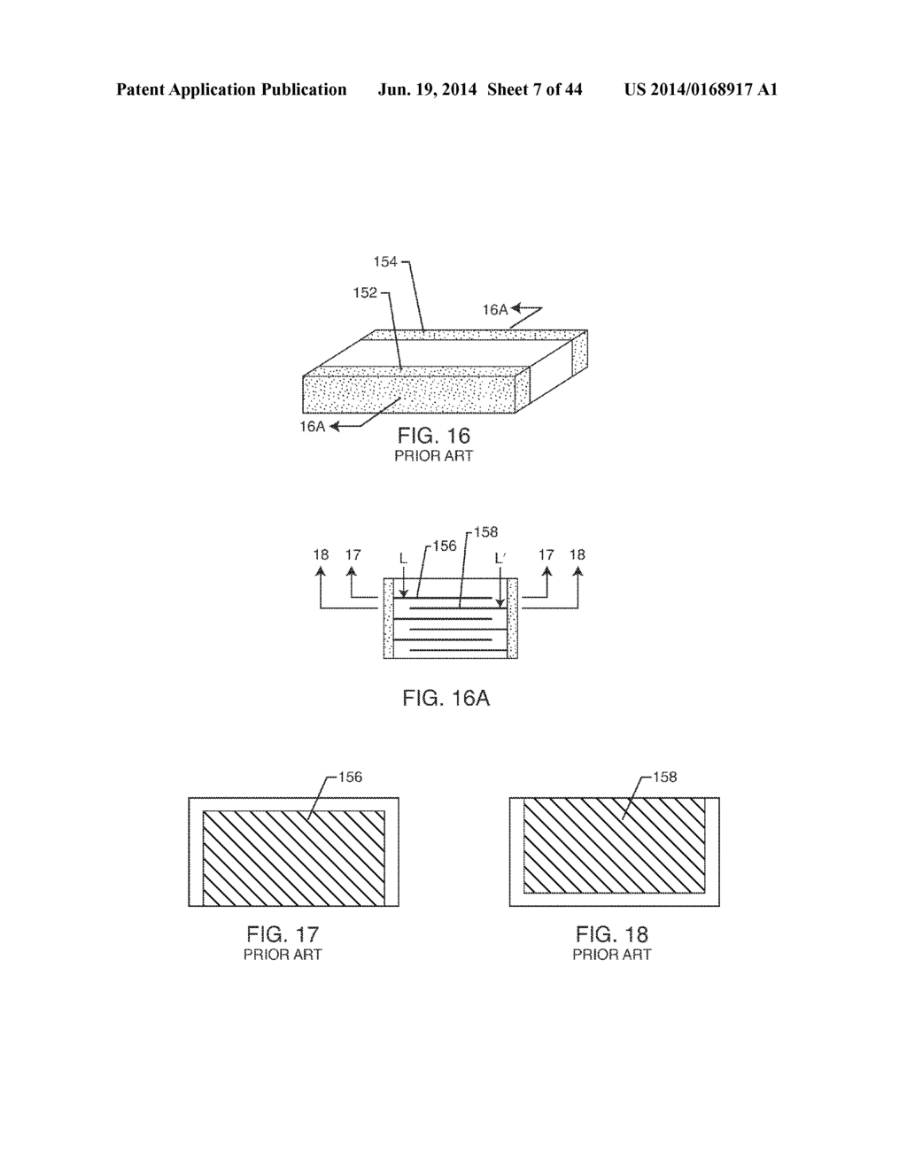 LOW INDUCTANCE AND LOW RESISTANCE HERMETICALLY SEALED FILTERED FEEDTHROUGH     FOR AN AIMD - diagram, schematic, and image 08