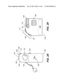 Speech Processor Cases diagram and image